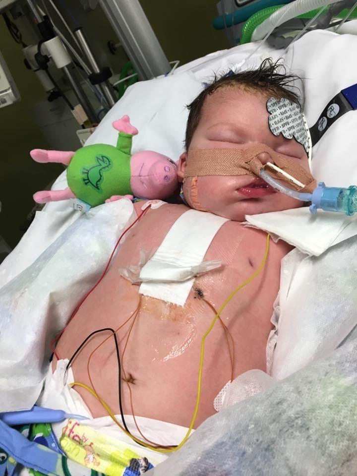 Son 3 months old surgery